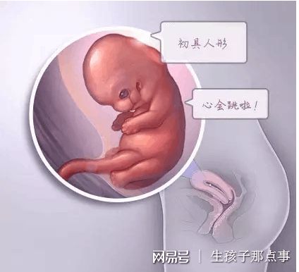 无精症成功案例